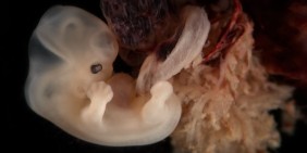 Sechs Wochen alter Embryo | Bild: lunar caustic / CC BY 2.0