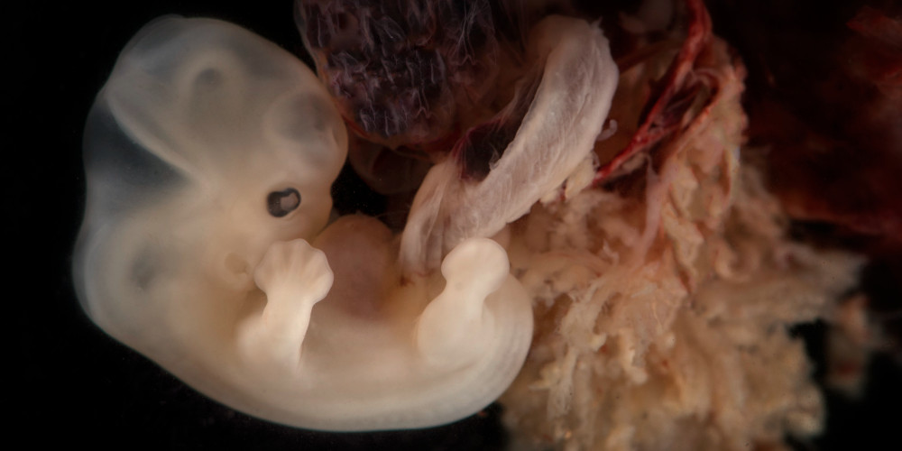 embryo-a.jpg