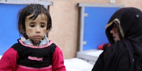 An Unterernährung leidendes afghanisches Kind in einem Krankenhaus in Kabul | Bild: picture alliance / AA | Sayed Khodaiberdi Sadat